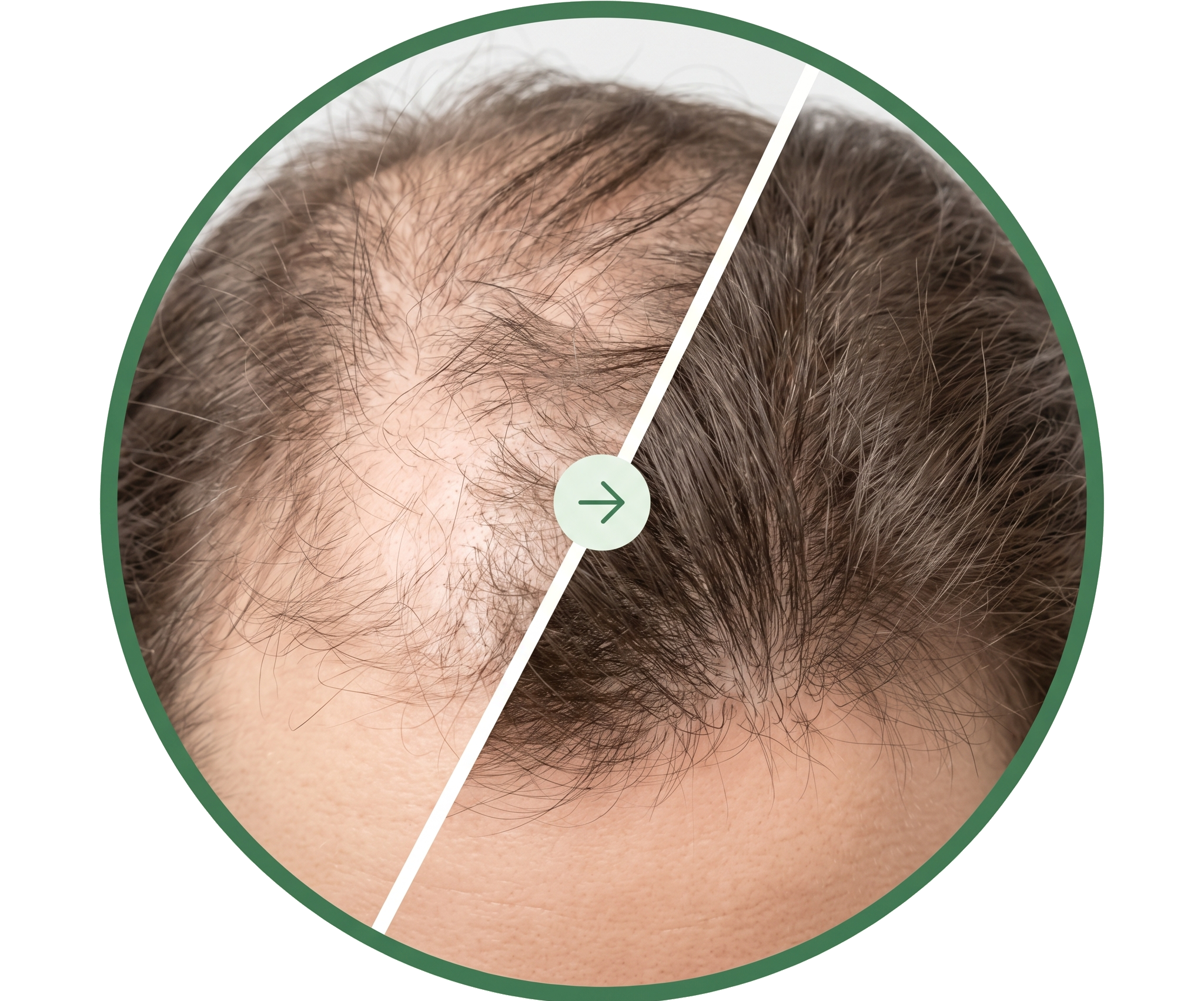 Voor en na HairRoll